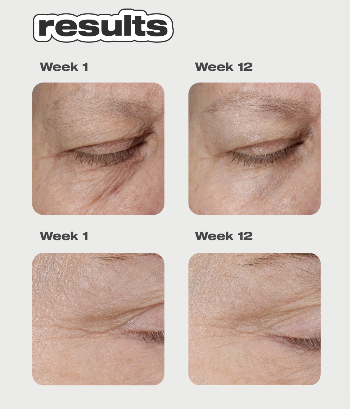 Freeze Frame Peptide Serum Concentrate
