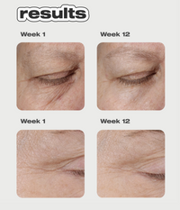 Freeze Frame Peptide Serum Concentrate