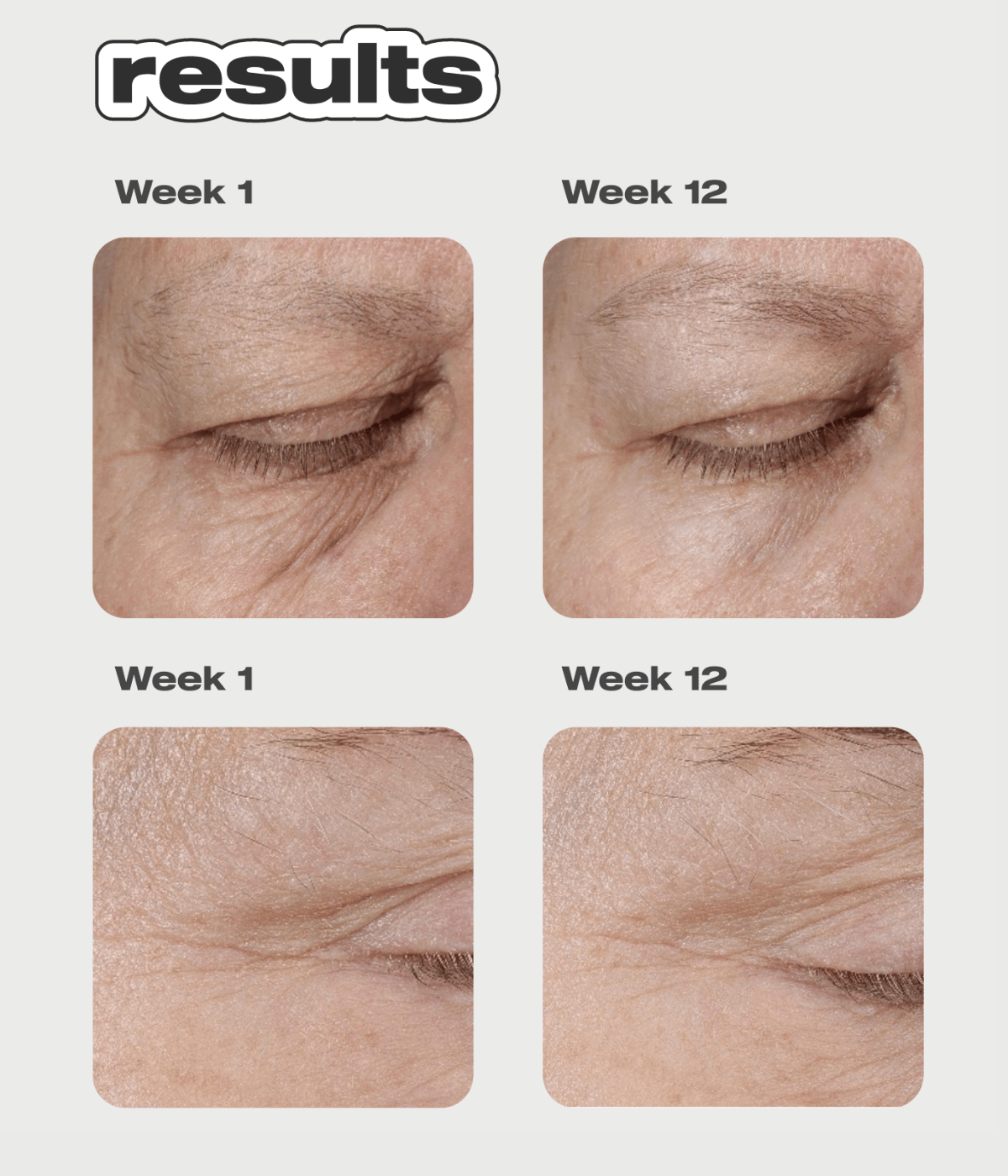 Freeze Frame Peptide Serum Concentrate – Educated Mess