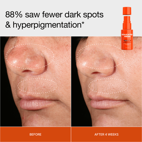 Golden Hour Gold-Stabilized Vitamin C Serum - Educated Mess