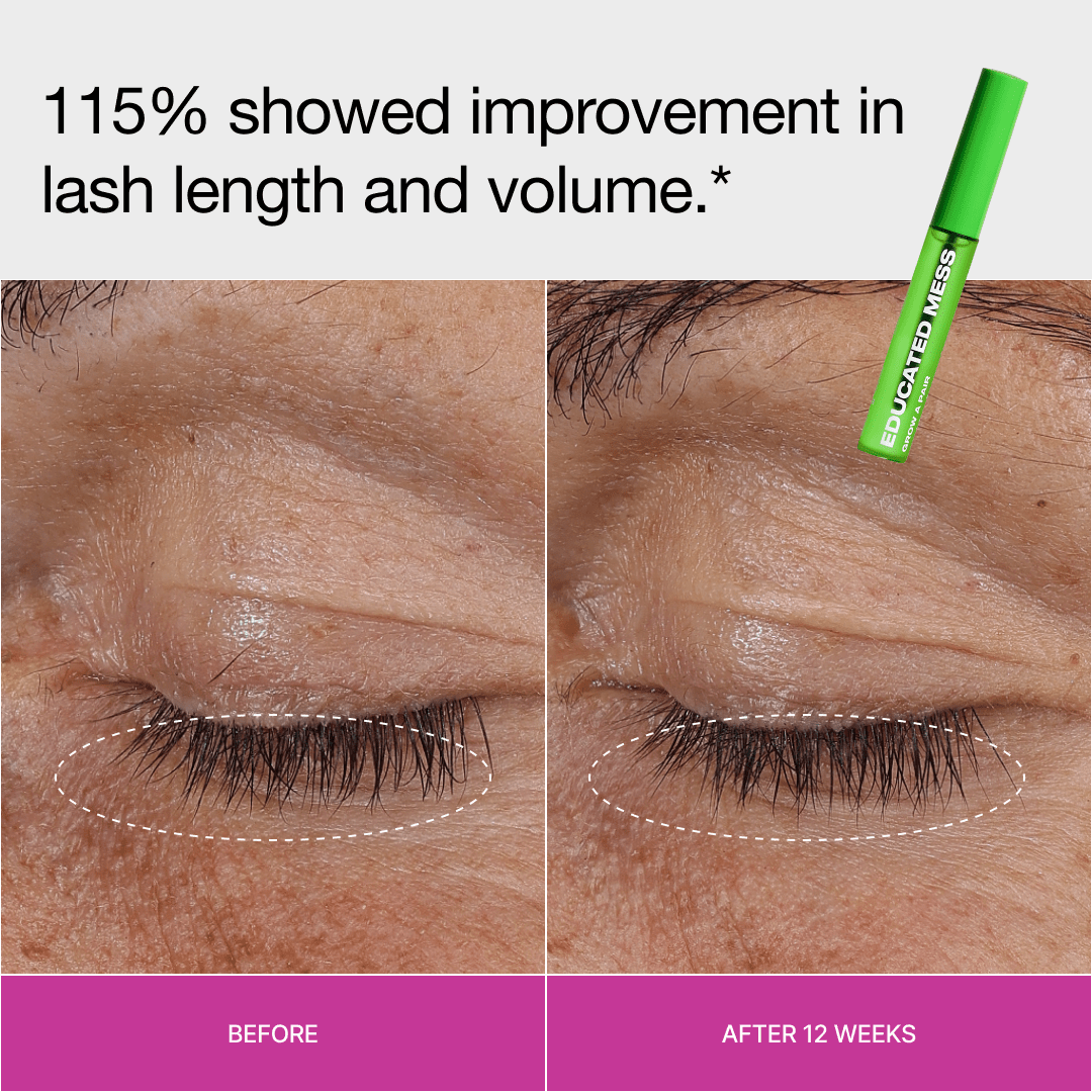 Lash and Brow Serum Without Prostaglandins | Grow A Pair